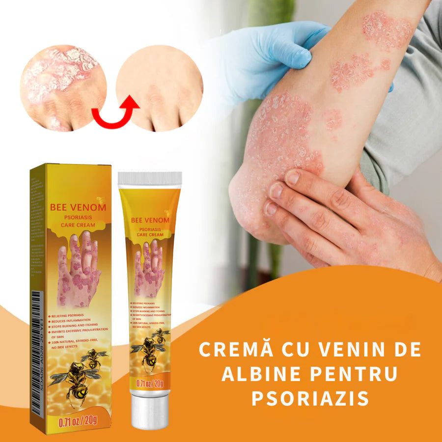 Cremă cu Venin de Albine pentru Psoriazis și Eczeme